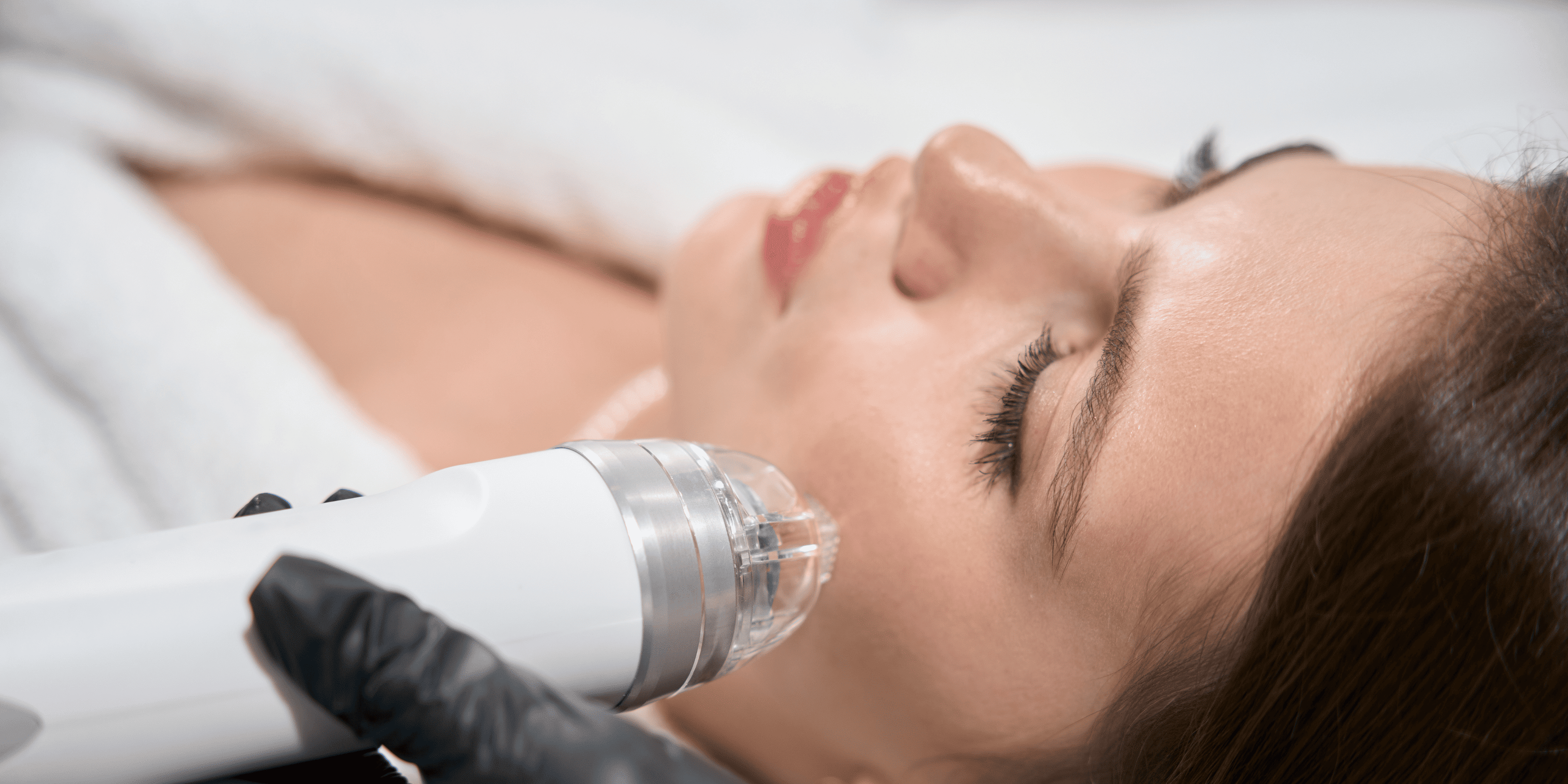 Microneedling and Dermal Stamping